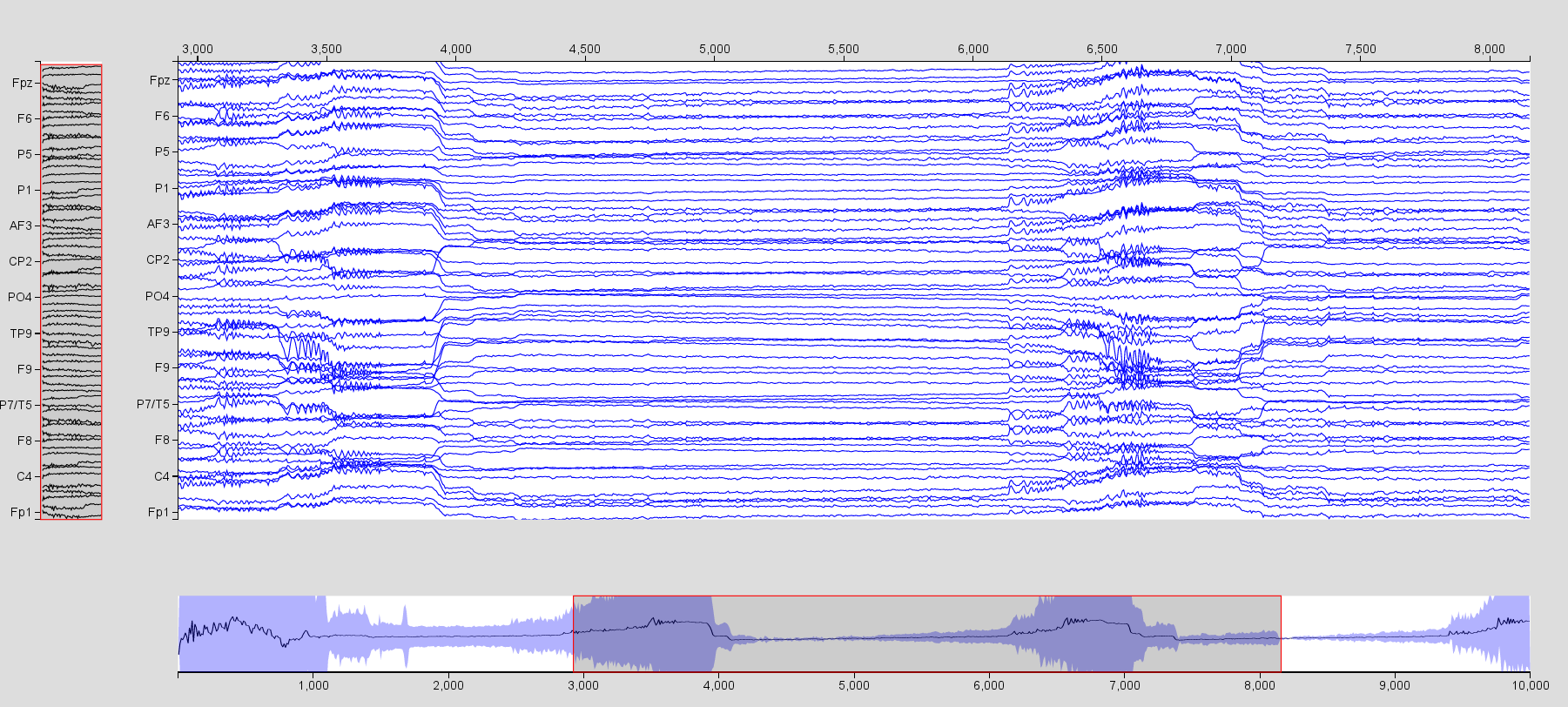EEG time series of the simulation